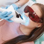 Layanan Bleaching Gigi | Spesialis Gigi dan Mulut Klinik Utama Pandawa