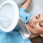 Layanan Veneer | Spesialis Gigi dan Mulut Klinik Utama Pandawa